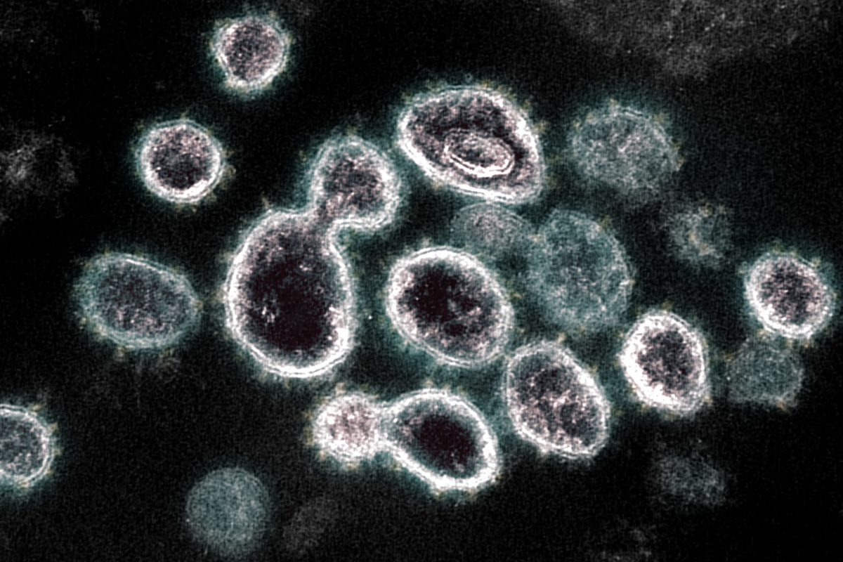 Según los científicos belgas, la unión a la integrina beta-1 promueve la entrada del virus en la célula. 